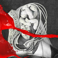Iamx - I Come With Knives загрузить